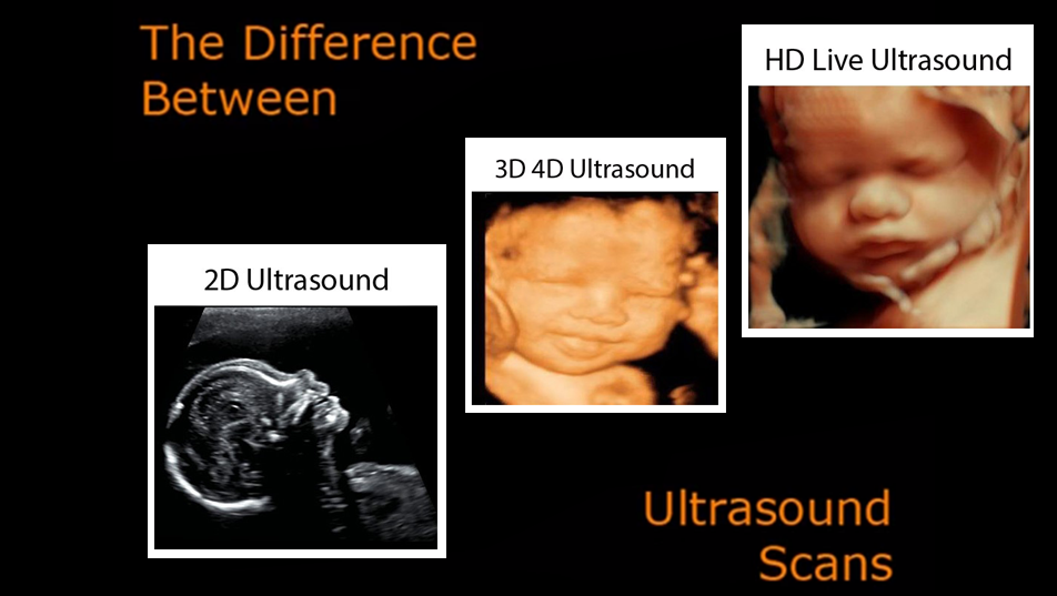 Examples of our 4D ultrasounds in Tampa, FL